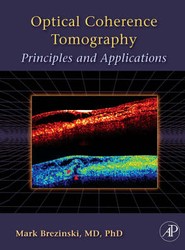 Optical Coherence Tomography