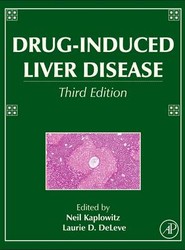 Drug-Induced Liver Disease