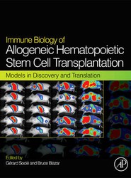 Immune Biology of Allogeneic Hematopoietic Stem Cell Transplantation