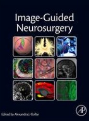 Image-Guided Neurosurgery