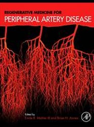 Regenerative Medicine for Peripheral Artery Disease