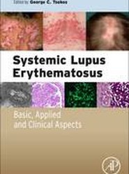 Systemic Lupus Erythematosus