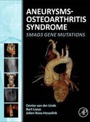 Aneurysms-Osteoarthritis Syndrome
