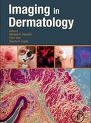 Imaging in Dermatology
