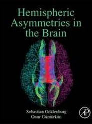 The Lateralized Brain
