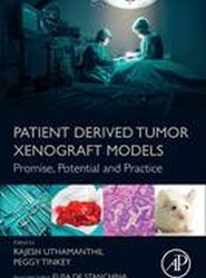 Patient Derived Tumor Xenograft Models