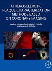 Atherosclerotic Plaque Characterization Methods Based on Coronary Imaging