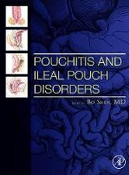 Pouchitis and Ileal Pouch Disorders