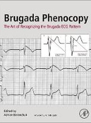 Brugada Phenocopy