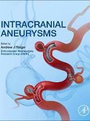Intracranial Aneurysms