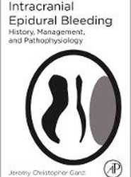 Intracranial Epidural Bleeding