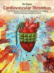 Cardiovascular Thrombus