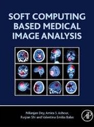 Soft Computing Based Medical Image Analysis