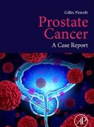 Prostate Cancer