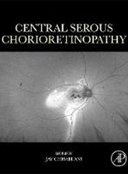 Central Serous Chorioretinopathy