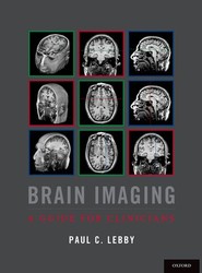 Brain Imaging