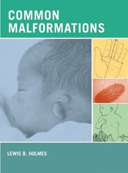 Common Malformations