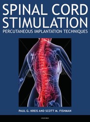 Spinal Cord Stimulation