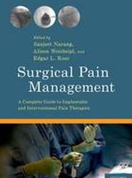 Surgical Pain Management