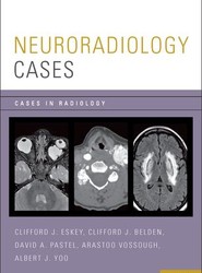 Neuroradiology Cases
