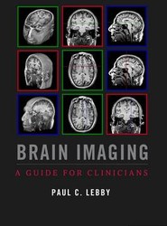 Brain Imaging