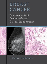 Breast Cancer