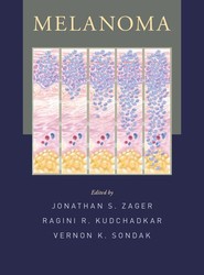 Melanoma