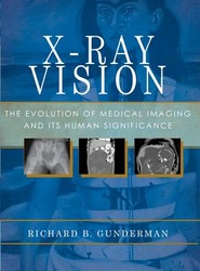X-Ray Vision