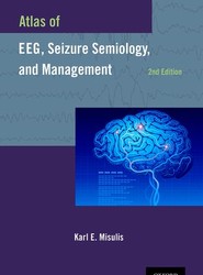 Atlas of EEG, Seizure Semiology, and Management