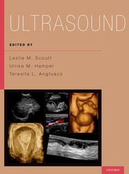 Ultrasound
