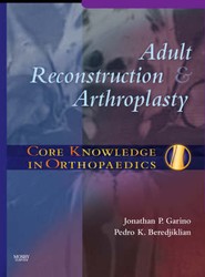 Core Knowledge in Orthopaedics: Adult Reconstruction and Arthroplasty