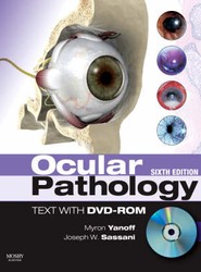 Ocular Pathology
