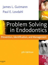 Problem Solving in Endodontics