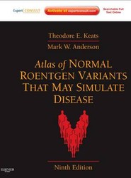Atlas of Normal Roentgen Variants That May Simulate Disease