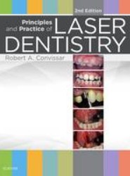 Principles and Practice of Laser Dentistry