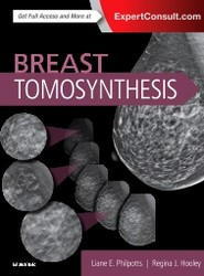 Breast Tomosynthesis