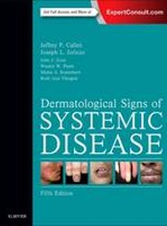 Dermatological Signs of Systemic Disease