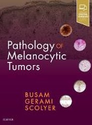 Pathology of Melanocytic Tumors