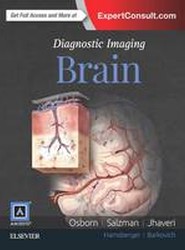 Diagnostic Imaging: Brain