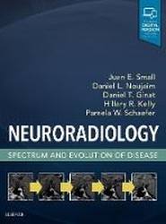 Neuroradiology: Spectrum and Evolution of Disease
