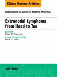 Extranodal Lymphoma from Head to Toe, An Issue of Radiologic Clinics of North America: Volume 54-4