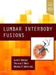 Lumbar Interbody Fusions