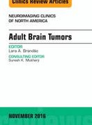 Adult Brain Tumors, An Issue of Neuroimaging Clinics of North America: Volume 26-4