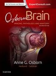 Osborn's Brain
