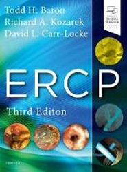 ERCP