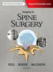 Imaging in Spine Surgery