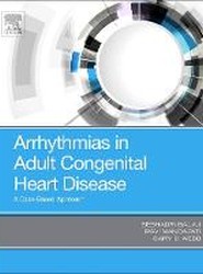 Arrhythmias in Adult Congenital Heart Disease