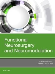 Functional Neurosurgery and Neuromodulation
