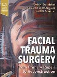Facial Trauma Surgery