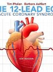 The 12-Lead ECG in Acute Coronary Syndromes